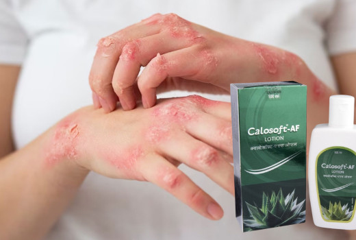 Calosoft AF Lotion: A Comprehensive Guide to Ingredients, Benefits, and Uses