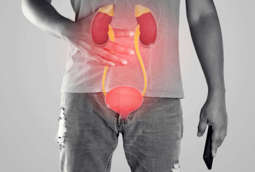 Top 5 Homeopathy Medicines For Kidney Stone Treatment