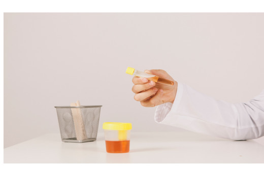 What is Homeopathic Medicine for Haematuria?