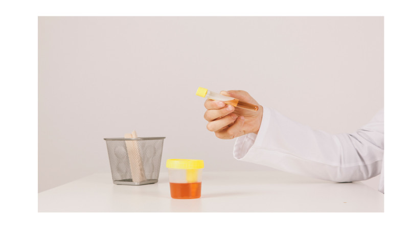 What is Homeopathic Medicine for Haematuria?