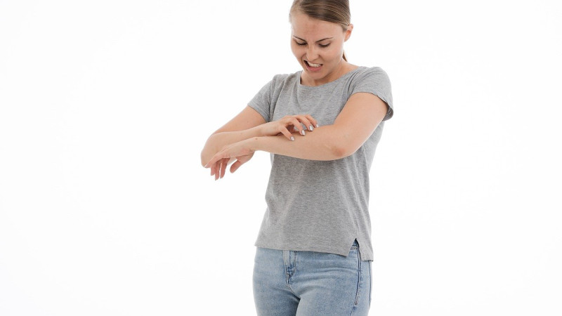 Homeopathic Medicine For Hives