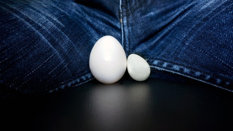 Treatment with homeopathy for HYDROCELE