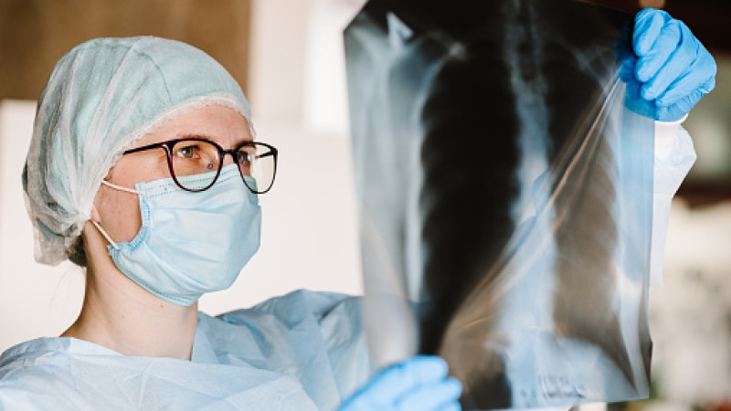 What is Homeopathy Medicine for Acute Osteomyelitis?