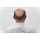 Homeopathic Medicine for Alopecia & Bald Patches