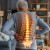 Homeopathic Medicine for Osteoporosis