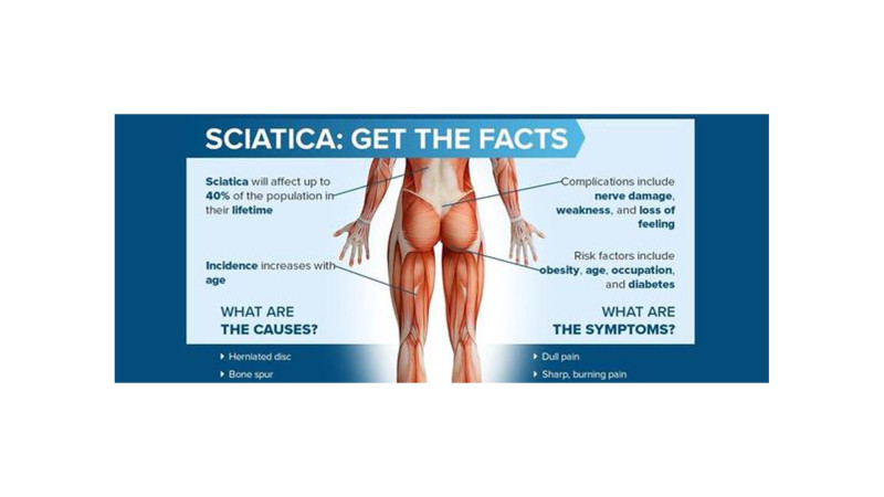 What is Homeopathic Medicine for Sciatica Pain Relief?