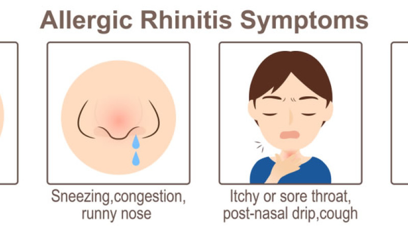 Can Allergy Rhinitis be Permanently Cured by Homeopathy?
